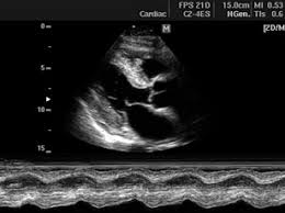 Critical Care Ultrasound Course Rwjuh New Brunswick