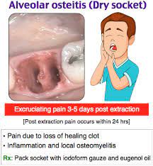 Rosh Review Dental Hygiene School Dentistry Dental Life