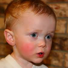 How to Reduce a Child's Fever