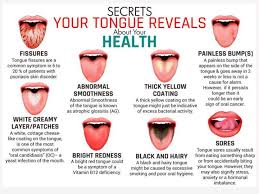 What Does Your Tongue Tell You About Your Thyroid Health Tips Health Remedies