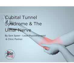 Cubital Tunnel Syndrome