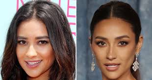 Has Shay Mitchell Had Plastic Surgery? Before, After Photos