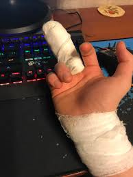 Video for how to play osu tutorial how to play osu! Can Lay Out A Video How Do I Play With A Broken Finger 4000 Pp Mouse Keyboard Osugame