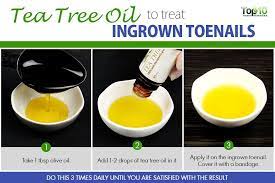 Home Remedies For Ingrown Toenails Top 10 Home Remedies Ingrown Toe Nail Tea Tree Oil Benefits Toe Nails
