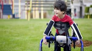 Belirti ve semptomlar bebeklik döneminde veya okul. Serebral Palsi Ozgur Ozdemir Ozel Egitim Okulu