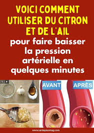 Epingle Sur Sante