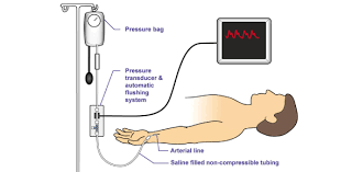 This quiz tests your knowledge of these rules. Arterial Line Quiz Art Trivia Test Proprofs Quiz
