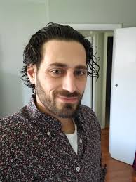 Do I still have a celebrity doppelganger after getting a unibrow scar?