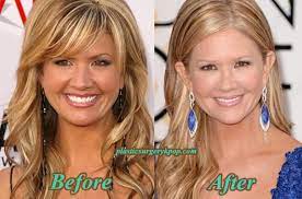 While nancy o'dell joins us in our living rooms on entertainment tonight, there's much more to this. Nancy O Dell S Magic Of Plastic Surgery Married With 1 Daughter Holidays With Husband In Boston
