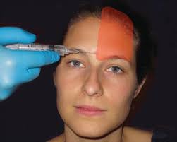 Regional Anesthesia (Nerve Blocks)