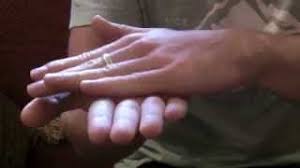 Image result for Rapid Alternating Movements