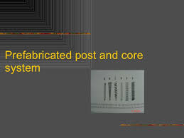 Post And Core