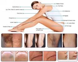 Trilaser Laser Hair Removal Machine Laser Hair Removal Machine Laser Hair Removal Hair Removal Machine