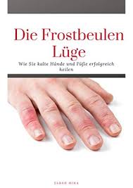 Amazon Com Die Frostbeulen Luge Wie Sie Kalte Fusse Und Hande Erfolgreich Heilen German Edition Ebook Mika Sarah Kindle Store