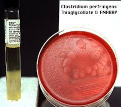The significance of clostridium spp. Dm Lab 17
