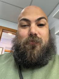 I got my first prosthetic eye today and my ocularist made me an all black  one too! I guess I'm half demon.