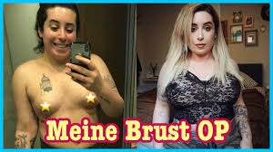Wer unter haarausfall leidet, ist häufig vor allem daran interessiert, eine permanente lösung dagegen zu finden. Meine Brust Op Vorher Nachher Jolina Mennen Youtube