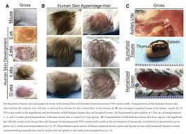 Maybe you would like to learn more about one of these? Stacy Trasancos On Twitter Aborted Baby Scalps Grafted Onto Mice Their Organs Transplanted Humanized Mice Developed At The University Of Pittsburgh All To Study The Immune System Supported By Dr Fauci S Niaid
