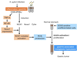 Or, the cause may be a different medical condition that is not cancer. New Study Explains How Inflammation Causes Ga Eurekalert