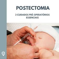 Postectomia: 3 cuidados pré operatórios essenciais