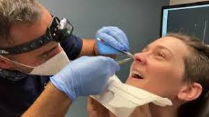 Chronicles of Sleep Apnea, Lung Health and Septoplasty