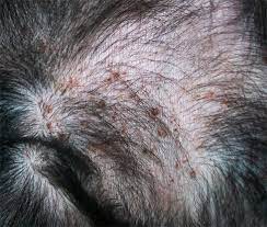 10 Rash Ideas Rashes Heat Rash Prickly Heat