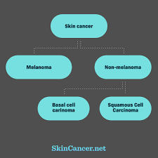 skin cancer types skincancer net