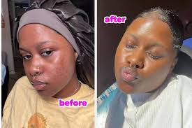 21 Splurge-Worthy Korean Skincare Products