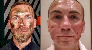 @przemek kossakowski najlepiej zna bohaterów programu, który pokochaliście!💙 na żywo, odpowie na wasze pytania o down the road 2 i tę niezwykłą podróż.🚌 n. Przemek Kossakowski Wstrzyknal Botoks I Powiekszyl Sobie Usta Moglem Poczuc Sie Piekny Wideoportal Tv Plotki Gwiazdy Komentarze Wideoportal Tv