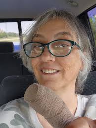 Successful medical procedure with twilight anesthesia