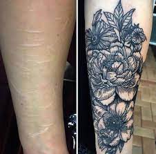 If the nerves are ok or damaged? Tattooing Scars And Stretchmarks Timeless Tattoo 2021