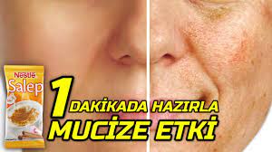 Abartisiz Lekeleri Kokunden Soken Cilt Beyazlatici Salep Maskesi 1 Dakikada Yap Guzellik Bakim Youtube Cilt Beyazlatma Dogal Cilt Bakimi Yuz Bakimi