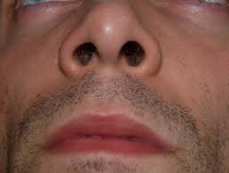 danielle chiasson i have a voice recorder in my purse but it's saying low battery so i figure. Nostril Simple English Wikipedia The Free Encyclopedia