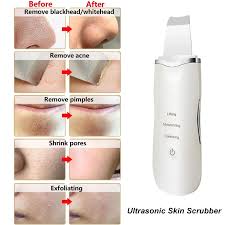 Ultrasonic Blackhead Removal Device Rechargeable Skin leather Shovel  Machine Ultrasonic Facial Skin Scrubber Blackheads Remover Machine Removes  Blackheads, Acne, Pimple, Black Spots | Deep Face Lifting, Moisturizing,  Cleansing - Face Lifting Device |