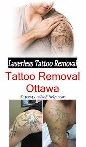 Posted by cris no h on may 16, 2015 may 26, 2015. Cream Indiahyperpigmentation Laser Removal Removalhow Tattoo Tattoo Removal Cream India Hyperpigmentation Diy Tattoo Hyperpigmentierung Tattooentfernung