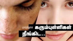 How Remove Dark Spots On Face Within 2 Days Tamil Beauty Tips Dark Spots On Face Spots On Face Age Spots On Face