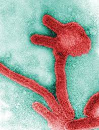 In marburg disease, mri typically shows multiple focal t2 lesions of varying size, which. Marburg Virus Disease Guinea Confirms West Africa S First Case Of Rare Ebola Like Disease Cnn