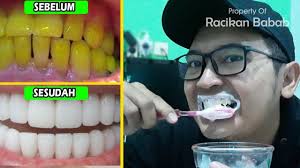 Cara Memutihkan Gigi Secara Alami Di Rumah Pemutihgigialami Pemutih Gigi Pemutih Gigi Alami Gigi