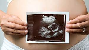 Hallo, ich bin aktuell fast in der 26.ssw und habe mein kind anfänglich eher spät gespürt, erstmalig ab der 22.ssw und da nur vereinzelt. Die Schwangerschaft In Der 6 Woche Das Baby Bewegt Sich Gesundheits Frage De