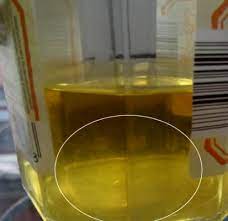 نتائج تجاربي لمعرفة الحمل شخصيا هل تحاولين الإنجاب بيبي سنتر آرابيا