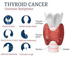 Thyroid cancer is not very common tumor that develops in the neck and, in most cases, a correct treatment has benign course. Thyroid Cancer Treatment In Punjab Thyroid Cancer Treatment Cost In Ludhiana
