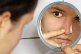Image result for BLACKHEADS