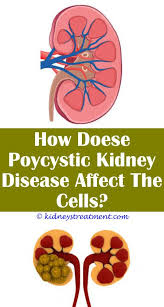 Pin On What Is Kidney Disease