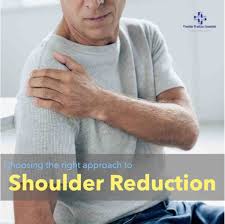 Image result for Shoulder Relocation Maneuvers