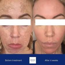 Dr Kathryn Hogg, Facial Aesthetics Consultant