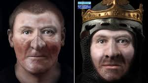 A plaster cast of king Robert the Bruce of Scotland's skull