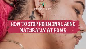 Some women experience hormonal acne as part of their monthly menstrual cycle. How To Stop Hormonal Acne Naturally At Home Skincare Top List