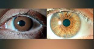 Cuanto Cuesta Tener Los Ojos Del Color Que Siempre Has Querido Tecnologia Cinco Dias