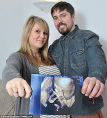 L'expression faire un doigt d'honneur est, dans les cultures occidentales, une altération de l'expression plus ancienne faire un doigt. 13 Idees De Echo Echographie Echographie Bebe Elephant Asiatique