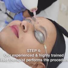 The pigment in the hair follicle absorbs the pulse, which damages the follicle enough to slow hair regrowth. Eyebrow Laser Hair Removal Cost Skin Specialist In Rajendra Nagar